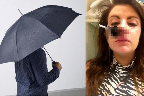 người phụ nữ bị tai nạn vì ô dù
